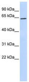 Histone-lysine N-methyltransferase SUV39H1 antibody, TA330559, Origene, Western Blot image 