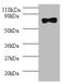 SAM And HD Domain Containing Deoxynucleoside Triphosphate Triphosphohydrolase 1 antibody, A53154-100, Epigentek, Western Blot image 