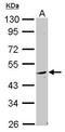 WD repeat, SAM and U-box domain-containing protein 1 antibody, GTX116382, GeneTex, Western Blot image 