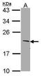 SERTA Domain Containing 1 antibody, GTX106457, GeneTex, Western Blot image 