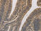 ELOVL Fatty Acid Elongase 1 antibody, CSB-PA939360, Cusabio, Immunohistochemistry paraffin image 