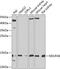 NADH:Ubiquinone Oxidoreductase Subunit A6 antibody, GTX65550, GeneTex, Western Blot image 