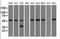 Alpha-1-antitrypsin antibody, orb181452, Biorbyt, Western Blot image 