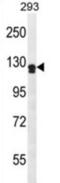 Unc-5 Netrin Receptor D antibody, abx027189, Abbexa, Western Blot image 