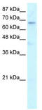 HR Lysine Demethylase And Nuclear Receptor Corepressor antibody, TA332072, Origene, Western Blot image 