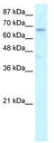 HR Lysine Demethylase And Nuclear Receptor Corepressor antibody, TA332072, Origene, Western Blot image 