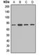 Dynein Cytoplasmic 1 Intermediate Chain 1 antibody, LS-C668692, Lifespan Biosciences, Western Blot image 