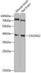 Calcium Voltage-Gated Channel Auxiliary Subunit Gamma 2 antibody, 22-294, ProSci, Western Blot image 