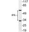 Plasminogen Activator, Tissue Type antibody, LS-C200028, Lifespan Biosciences, Western Blot image 