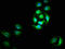 OTU Deubiquitinase 5 antibody, CSB-PA850298LA01HU, Cusabio, Immunofluorescence image 