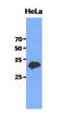 Glutamate-Cysteine Ligase Modifier Subunit antibody, GTX53719, GeneTex, Western Blot image 