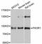 Phosphoinositide-3-Kinase Regulatory Subunit 1 antibody, LS-C746995, Lifespan Biosciences, Western Blot image 