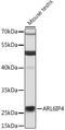 ADP Ribosylation Factor Like GTPase 6 Interacting Protein 4 antibody, LS-C748155, Lifespan Biosciences, Western Blot image 