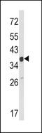 Actin Related Protein 2/3 Complex Subunit 1A antibody, TA324845, Origene, Western Blot image 