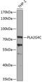 Phospholipase A2 Group IVC antibody, 23-158, ProSci, Western Blot image 