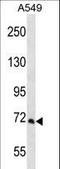 Propionyl-CoA Carboxylase Subunit Alpha antibody, LS-C163410, Lifespan Biosciences, Western Blot image 