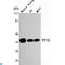 Serine/threonine-protein phosphatase PP1-beta catalytic subunit antibody, LS-C814108, Lifespan Biosciences, Western Blot image 