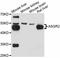 Asialoglycoprotein Receptor 2 antibody, abx126832, Abbexa, Western Blot image 