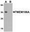 Transmembrane Protein 106A antibody, LS-B8814, Lifespan Biosciences, Western Blot image 