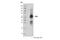 TNF Receptor Superfamily Member 25 antibody, 20772S, Cell Signaling Technology, Western Blot image 