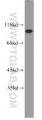 Cell Division Cycle 27 antibody, 10918-1-AP, Proteintech Group, Western Blot image 