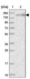 Early Endosome Antigen 1 antibody, NBP1-91860, Novus Biologicals, Western Blot image 