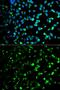 Thymidine Phosphorylase antibody, GTX33396, GeneTex, Immunofluorescence image 