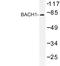 BTB Domain And CNC Homolog 1 antibody, LS-C176697, Lifespan Biosciences, Western Blot image 