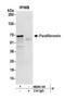 Cell Division Cycle 73 antibody, NB200-184, Novus Biologicals, Western Blot image 