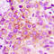 Catenin Delta 1 antibody, LS-C358960, Lifespan Biosciences, Immunohistochemistry paraffin image 