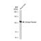 Androgen Receptor antibody, GTX01536, GeneTex, Western Blot image 