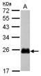 Cysteine Rich Protein 2 antibody, NBP2-16012, Novus Biologicals, Western Blot image 