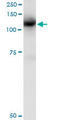 Cbl Proto-Oncogene antibody, LS-C196826, Lifespan Biosciences, Immunoprecipitation image 