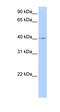 LOC641765 antibody, orb325644, Biorbyt, Western Blot image 