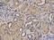 Hypoxia Inducible Factor 1 Subunit Alpha Inhibitor antibody, A02116, Boster Biological Technology, Immunohistochemistry frozen image 