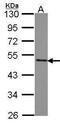 Splicing Factor 3b Subunit 4 antibody, PA5-28441, Invitrogen Antibodies, Western Blot image 