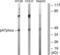 Neutrophil Cytosolic Factor 1 antibody, LS-B5698, Lifespan Biosciences, Western Blot image 