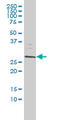 Survival Motor Neuron Domain Containing 1 antibody, LS-C133636, Lifespan Biosciences, Western Blot image 