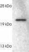 RAB3A, Member RAS Oncogene Family antibody, ab3335, Abcam, Western Blot image 