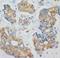 Keratin 18 antibody, LS-C171113, Lifespan Biosciences, Immunohistochemistry paraffin image 