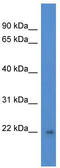 DiGeorge Syndrome Critical Region Gene 6 Like antibody, TA343084, Origene, Western Blot image 