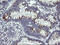 Interleukin-36 gamma antibody, M05759, Boster Biological Technology, Immunohistochemistry paraffin image 