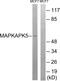 MAPK Activated Protein Kinase 5 antibody, LS-C199228, Lifespan Biosciences, Western Blot image 