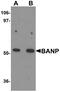 BTG3 Associated Nuclear Protein antibody, A05764, Boster Biological Technology, Western Blot image 