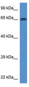 TATA-Box Binding Protein Associated Factor 6 Like antibody, TA329306, Origene, Western Blot image 