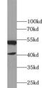 Nuclear Receptor Subfamily 1 Group H Member 2 antibody, FNab05834, FineTest, Western Blot image 