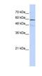 Glutamate Dehydrogenase 2 antibody, NBP1-55437, Novus Biologicals, Western Blot image 