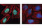 Lysine Methyltransferase 5A antibody, 2996S, Cell Signaling Technology, Immunocytochemistry image 