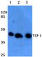 Transcription Factor 7 antibody, A01315-1, Boster Biological Technology, Western Blot image 