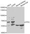 Tumor Protein P63 antibody, MBS127282, MyBioSource, Western Blot image 